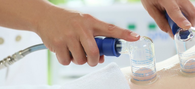 S.P.M. (Suction Pump Massage) by Weyergans